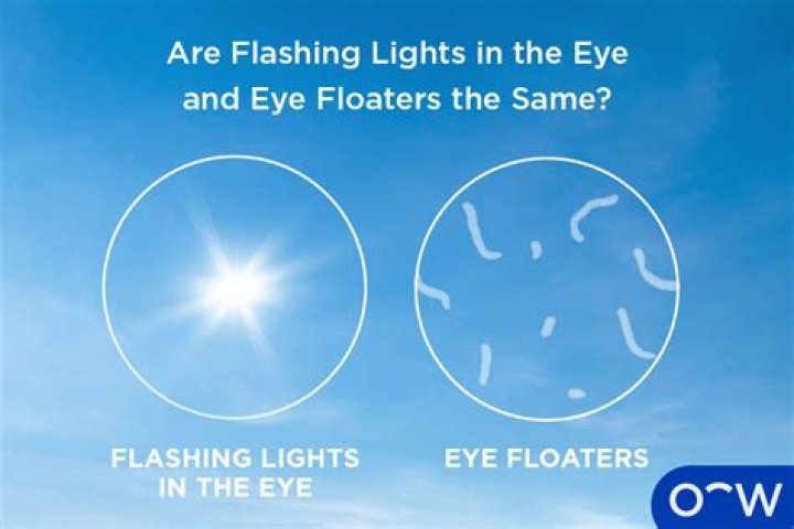 Seeing Clearly: How Your Eyes Adapt to Light with hdforhub